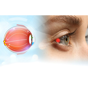 Biến chứng về mắt