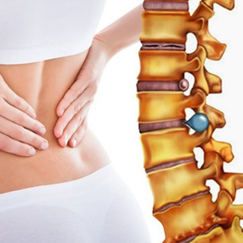 Thoái hóa cột sống